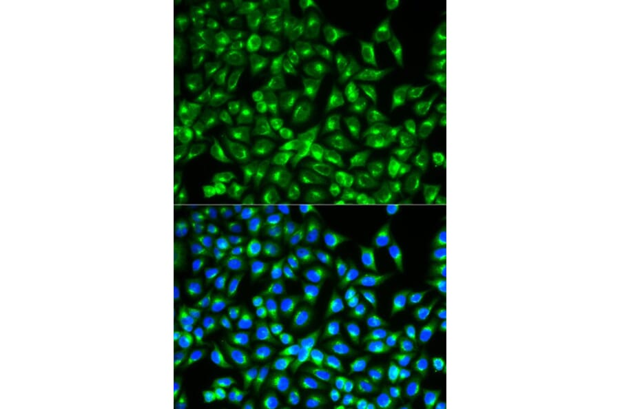 Immunofluorescence - CDC34 Antibody from Signalway Antibody (32860) - Antibodies.com