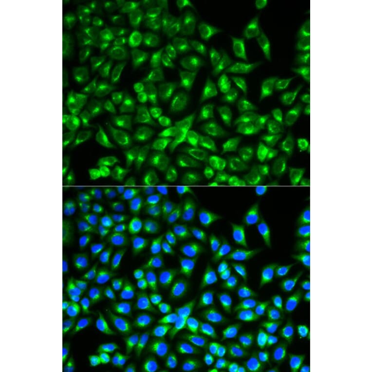 Immunofluorescence - CDC34 Antibody from Signalway Antibody (32860) - Antibodies.com