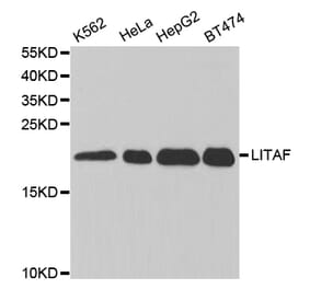 Western blot - LITAF Antibody from Signalway Antibody (32869) - Antibodies.com