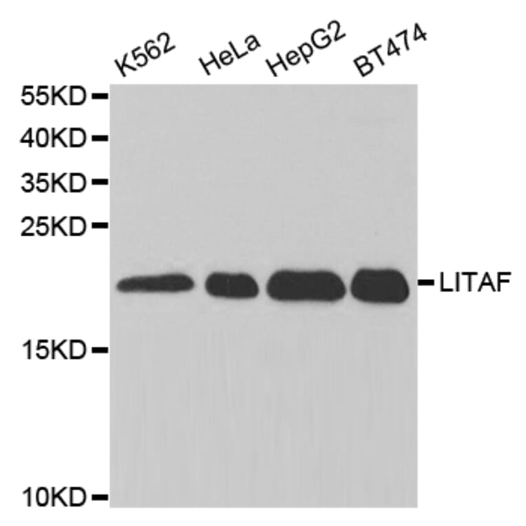 Western blot - LITAF Antibody from Signalway Antibody (32869) - Antibodies.com