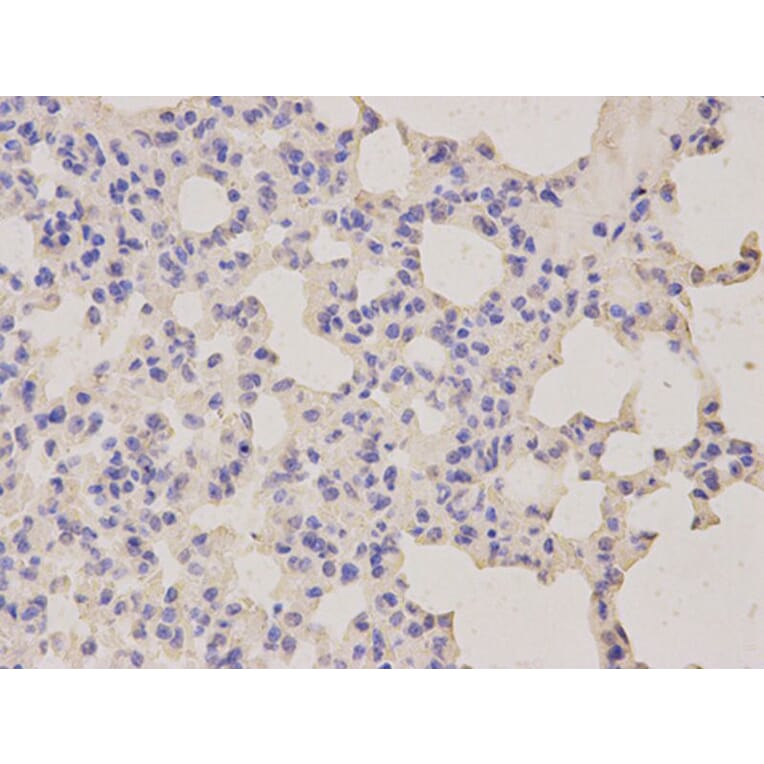 Immunohistochemistry - LITAF Antibody from Signalway Antibody (32869) - Antibodies.com