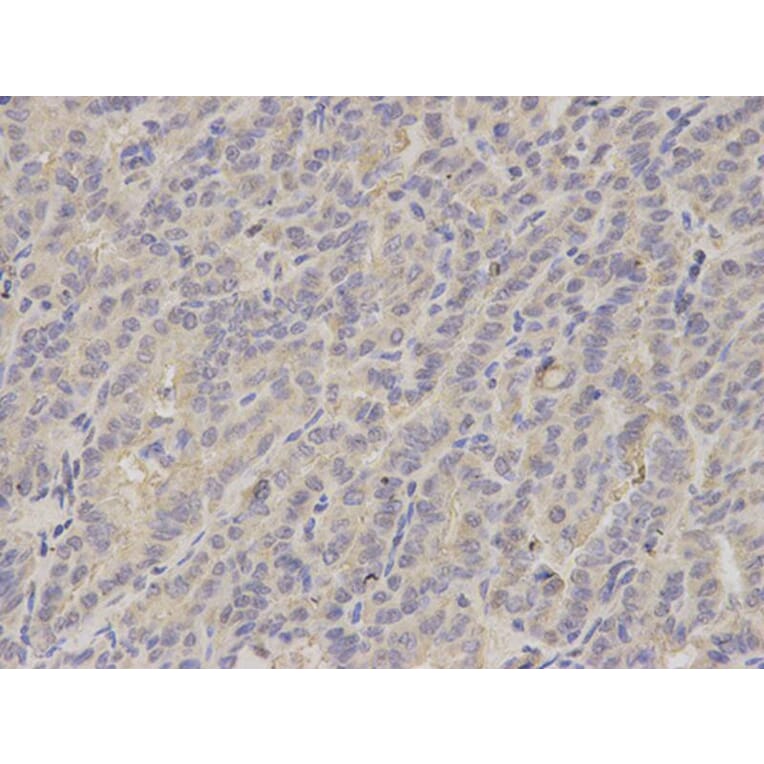 Immunohistochemistry - LITAF Antibody from Signalway Antibody (32869) - Antibodies.com