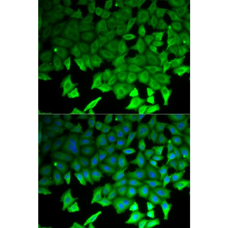 Immunofluorescence - LITAF Antibody from Signalway Antibody (32869) - Antibodies.com