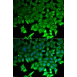 Immunofluorescence - LITAF Antibody from Signalway Antibody (32869) - Antibodies.com