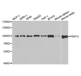 Western blot - PRPF3 Antibody from Signalway Antibody (32877) - Antibodies.com