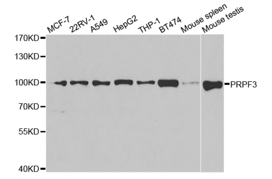 Western blot - PRPF3 Antibody from Signalway Antibody (32877) - Antibodies.com