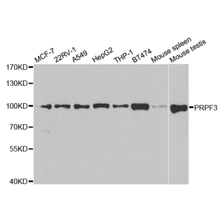 Western blot - PRPF3 Antibody from Signalway Antibody (32877) - Antibodies.com