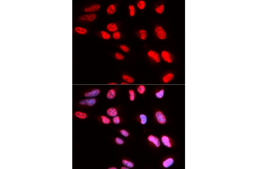 Immunofluorescence - PRPF3 Antibody from Signalway Antibody (32877) - Antibodies.com