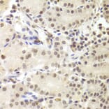 Immunohistochemistry - PRPF3 Antibody from Signalway Antibody (32877) - Antibodies.com