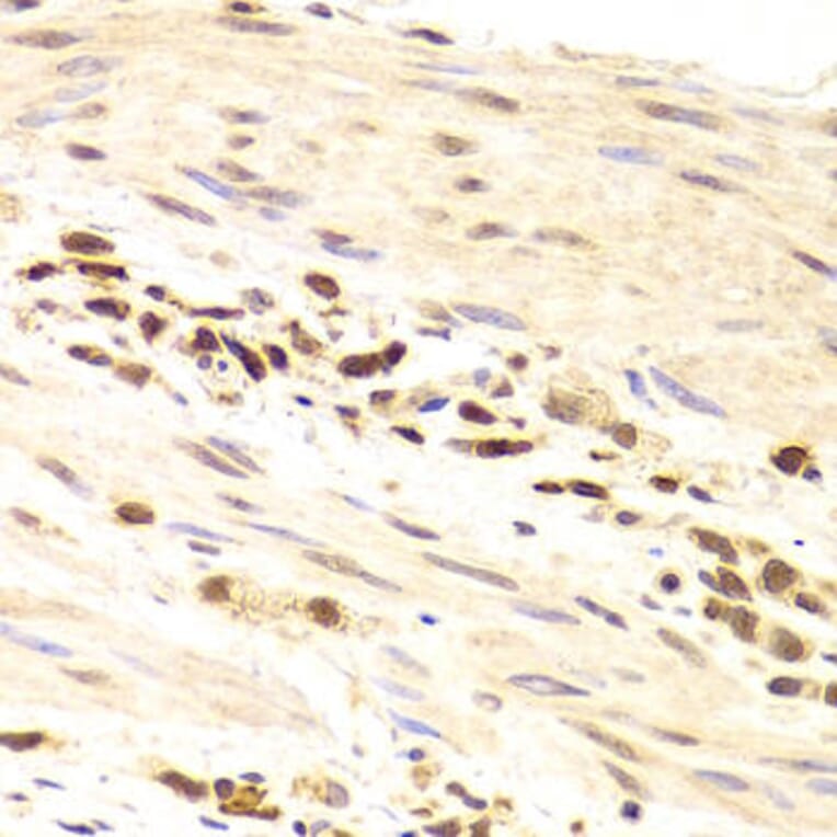 Immunohistochemistry - PRPF3 Antibody from Signalway Antibody (32877) - Antibodies.com