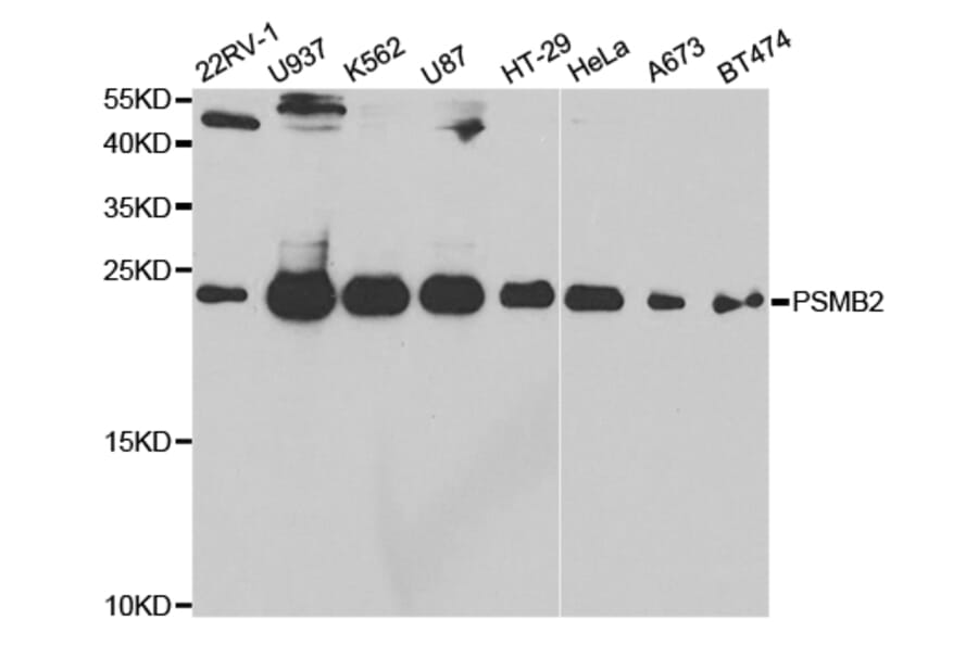 Western blot - PSMB2 Antibody from Signalway Antibody (32878) - Antibodies.com