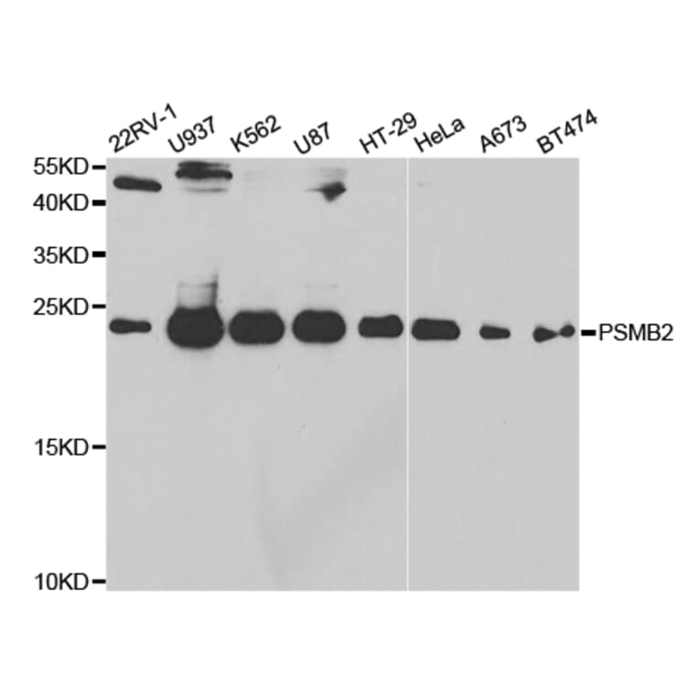 Western blot - PSMB2 Antibody from Signalway Antibody (32878) - Antibodies.com