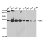 Western blot - PSMB2 Antibody from Signalway Antibody (32878) - Antibodies.com