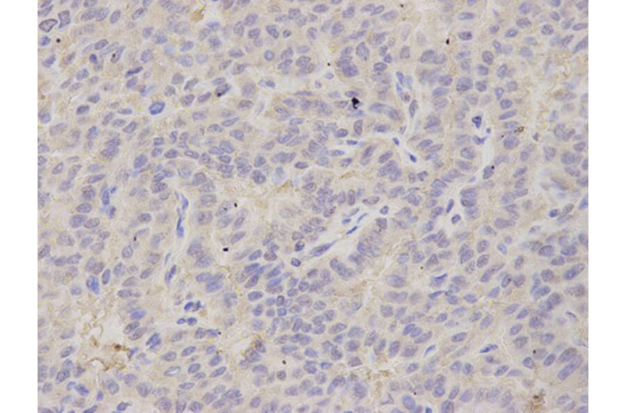 Immunohistochemistry - PSMB2 Antibody from Signalway Antibody (32878) - Antibodies.com