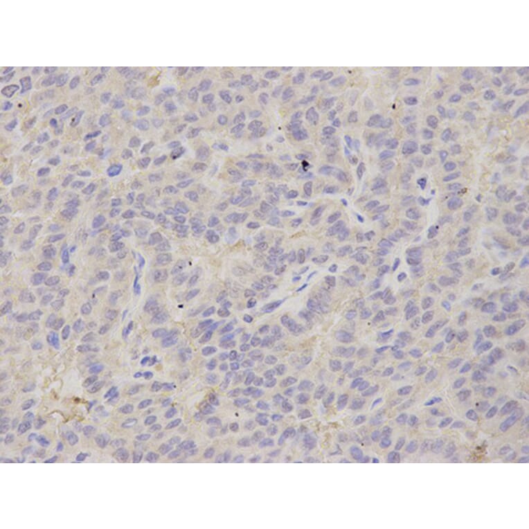 Immunohistochemistry - PSMB2 Antibody from Signalway Antibody (32878) - Antibodies.com