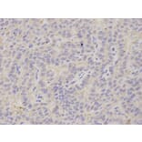 Immunohistochemistry - PSMB2 Antibody from Signalway Antibody (32878) - Antibodies.com