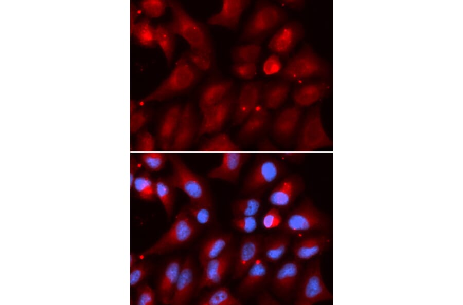 Immunofluorescence - PSMB2 Antibody from Signalway Antibody (32878) - Antibodies.com