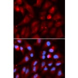 Immunofluorescence - PSMB2 Antibody from Signalway Antibody (32878) - Antibodies.com
