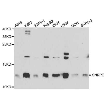 Western blot - SNRPE Antibody from Signalway Antibody (32883) - Antibodies.com