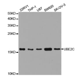 Western blot - UBE2C Antibody from Signalway Antibody (32889) - Antibodies.com