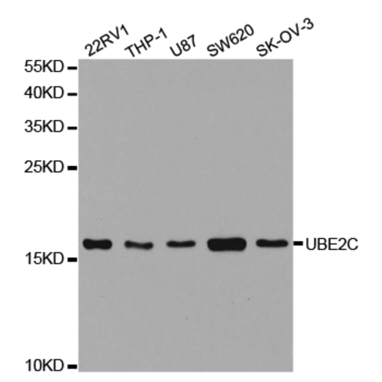 Western blot - UBE2C Antibody from Signalway Antibody (32889) - Antibodies.com