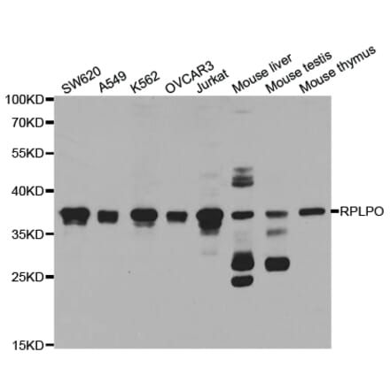 Western blot - RPLP0 Antibody from Signalway Antibody (32908) - Antibodies.com