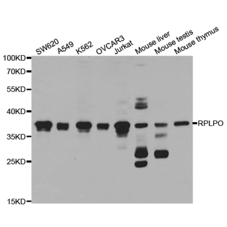 Western blot - RPLP0 Antibody from Signalway Antibody (32908) - Antibodies.com