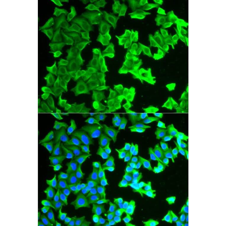 Immunofluorescence - RPLP0 Antibody from Signalway Antibody (32908) - Antibodies.com