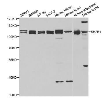Western blot analysis of extracts of various cell lines, using SH2B1 antibody.