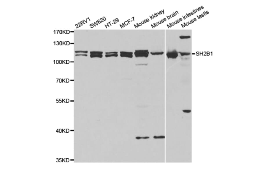 Western blot - SH2B1 Antibody from Signalway Antibody (32915) - Antibodies.com