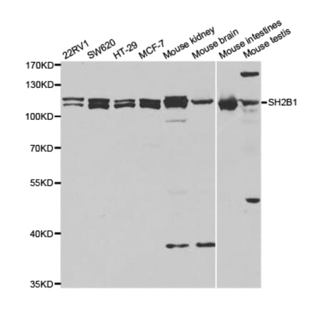 Western blot - SH2B1 Antibody from Signalway Antibody (32915) - Antibodies.com