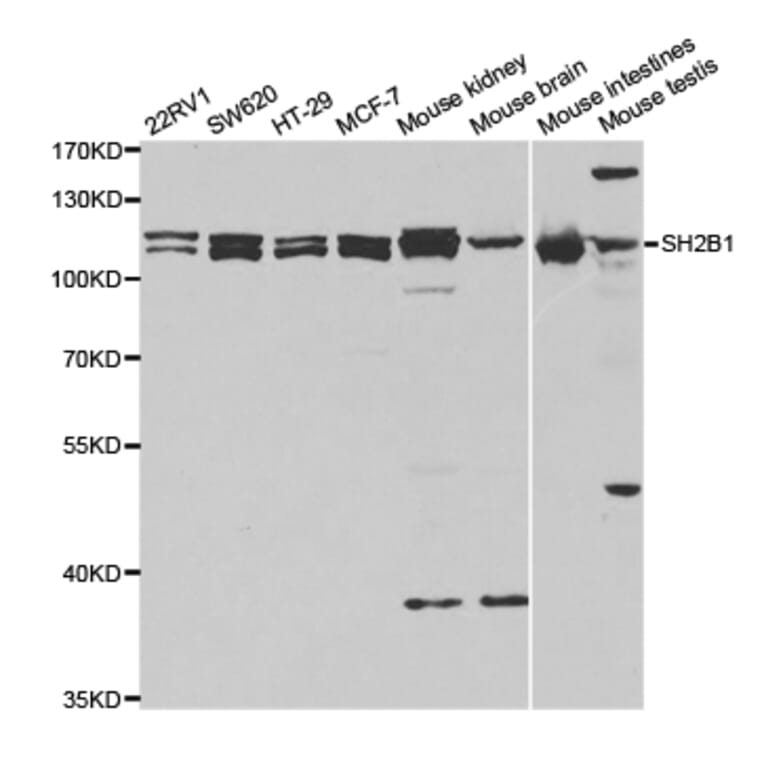 Western blot - SH2B1 Antibody from Signalway Antibody (32915) - Antibodies.com