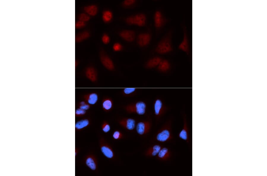 Immunofluorescence - SH2B1 Antibody from Signalway Antibody (32915) - Antibodies.com