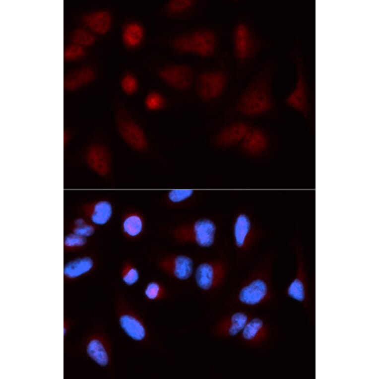 Immunofluorescence - SH2B1 Antibody from Signalway Antibody (32915) - Antibodies.com