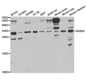 Western blot - RAB6A Antibody from Signalway Antibody (32921) - Antibodies.com