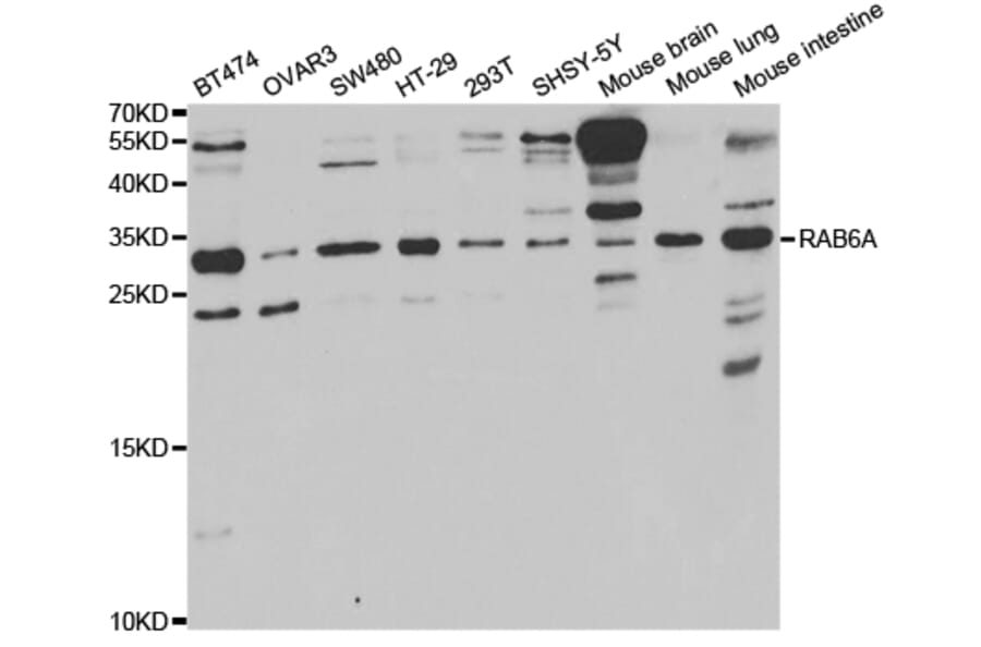 Western blot - RAB6A Antibody from Signalway Antibody (32921) - Antibodies.com