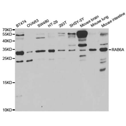 Western blot - RAB6A Antibody from Signalway Antibody (32921) - Antibodies.com