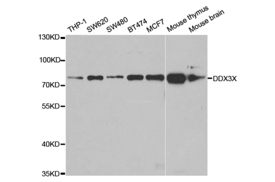 Western blot - DDX3X Antibody from Signalway Antibody (32938) - Antibodies.com