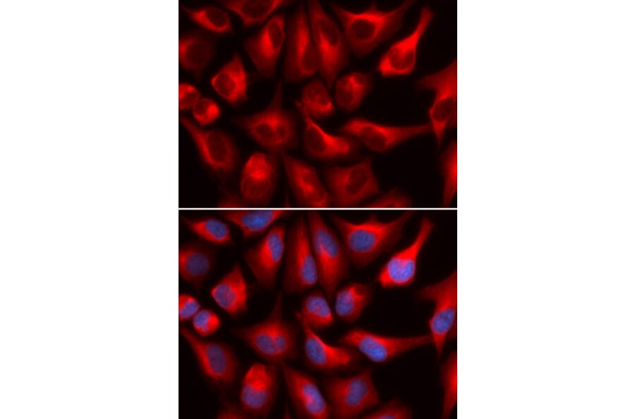 Immunofluorescence - DDX3X Antibody from Signalway Antibody (32938) - Antibodies.com