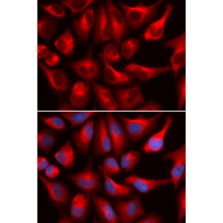 Immunofluorescence - DDX3X Antibody from Signalway Antibody (32938) - Antibodies.com