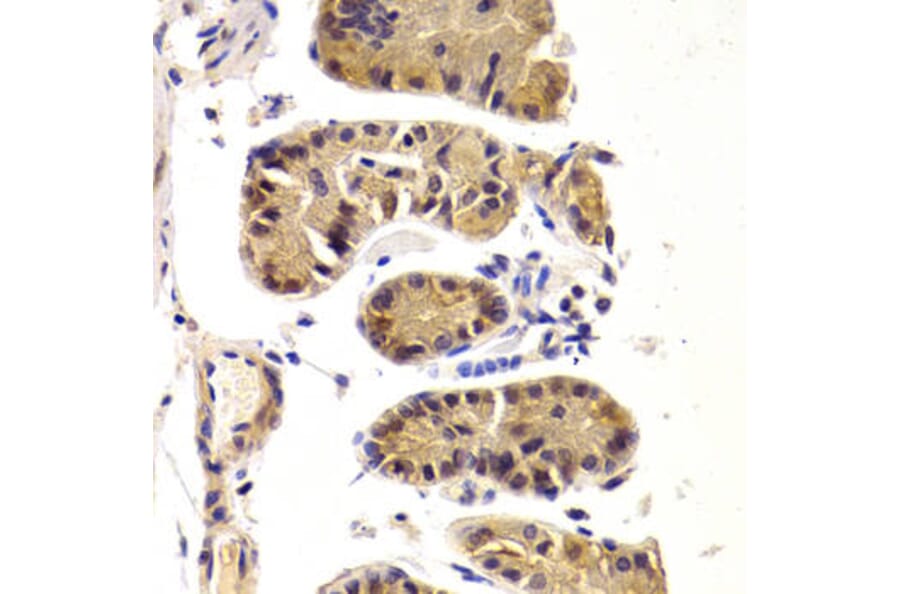 Immunohistochemistry - DDX3X Antibody from Signalway Antibody (32938) - Antibodies.com