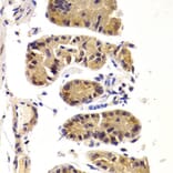 Immunohistochemistry - DDX3X Antibody from Signalway Antibody (32938) - Antibodies.com