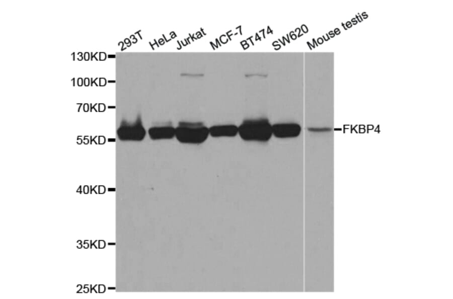 Western blot - FKBP4 Antibody from Signalway Antibody (32942) - Antibodies.com