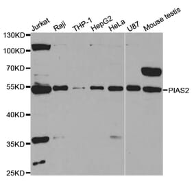 Western blot - PIAS2 Antibody from Signalway Antibody (32951) - Antibodies.com