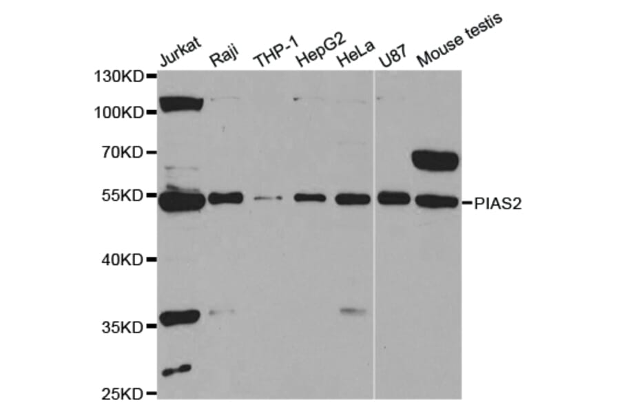 Western blot - PIAS2 Antibody from Signalway Antibody (32951) - Antibodies.com