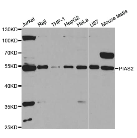 Western blot - PIAS2 Antibody from Signalway Antibody (32951) - Antibodies.com