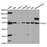 Western blot - PIAS2 Antibody from Signalway Antibody (32951) - Antibodies.com