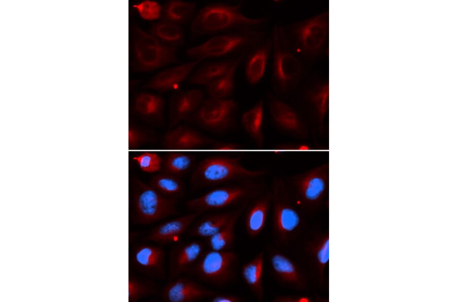 Immunofluorescence - PIAS2 Antibody from Signalway Antibody (32951) - Antibodies.com