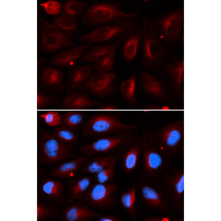 Immunofluorescence - PIAS2 Antibody from Signalway Antibody (32951) - Antibodies.com