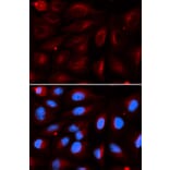 Immunofluorescence - PIAS2 Antibody from Signalway Antibody (32951) - Antibodies.com
